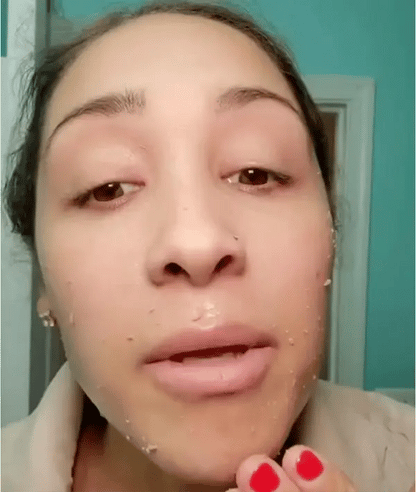 🔥BUY MORE SAVE MORE Peel Shot Glow Ampoule