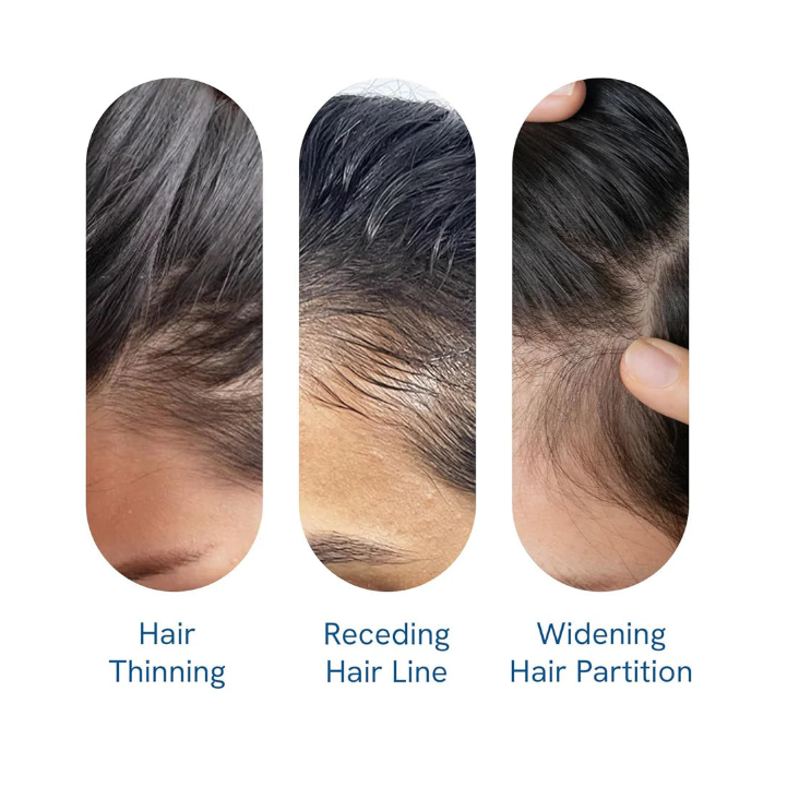 Be Bodywise Avancerad Hårväxt Roll-On-Serum | 3% Rosmarin | 2% Aminexil | 3% Redensyl | 2% Anagain | Präcisionsapplicator för skägg hud | Utan parabener och sulfater | Icke oliv och utan röra