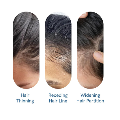 Be Bodywise Avancerad Hårväxt Roll-On-Serum | 3% Rosmarin | 2% Aminexil | 3% Redensyl | 2% Anagain | Präcisionsapplicator för skägg hud | Utan parabener och sulfater | Icke oliv och utan röra